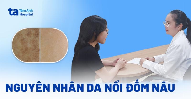 Chó bị đốm đen trên da do nám da