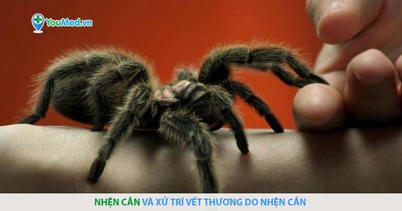 Dấu Hiệu Dị Ứng Nhện Tarantula