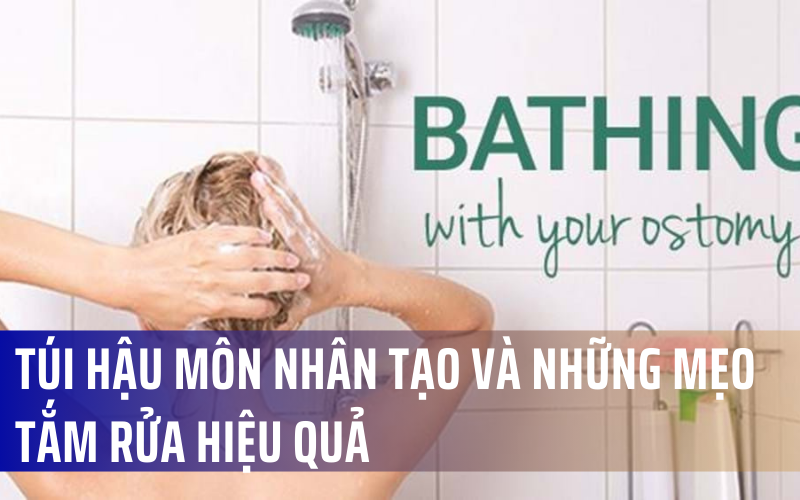 Mèo được chăm sóc hậu môn