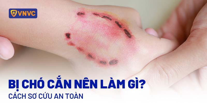 Cách ly chó nghi bị dại