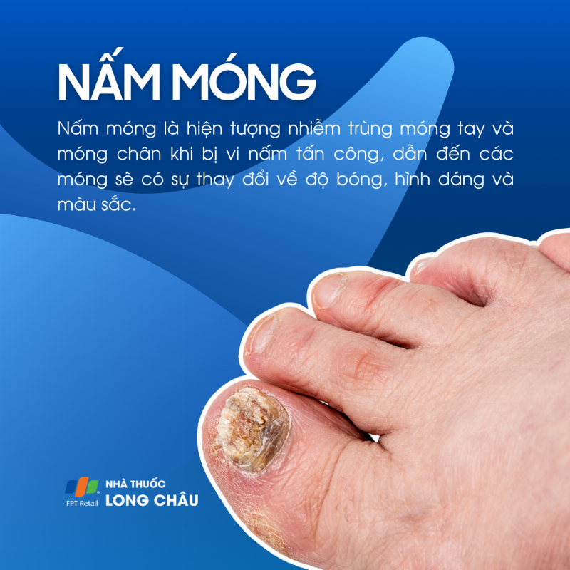 Nấm móng