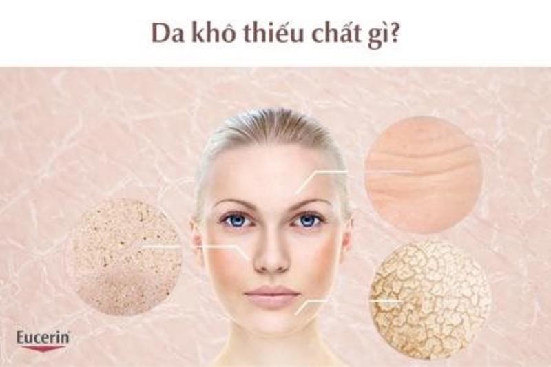 Sóc bông thiếu chất